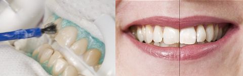 Ästhetische Zahnheilkunde