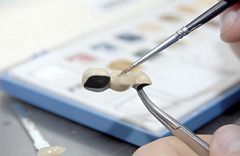 Hochwertiger Zahnersatz